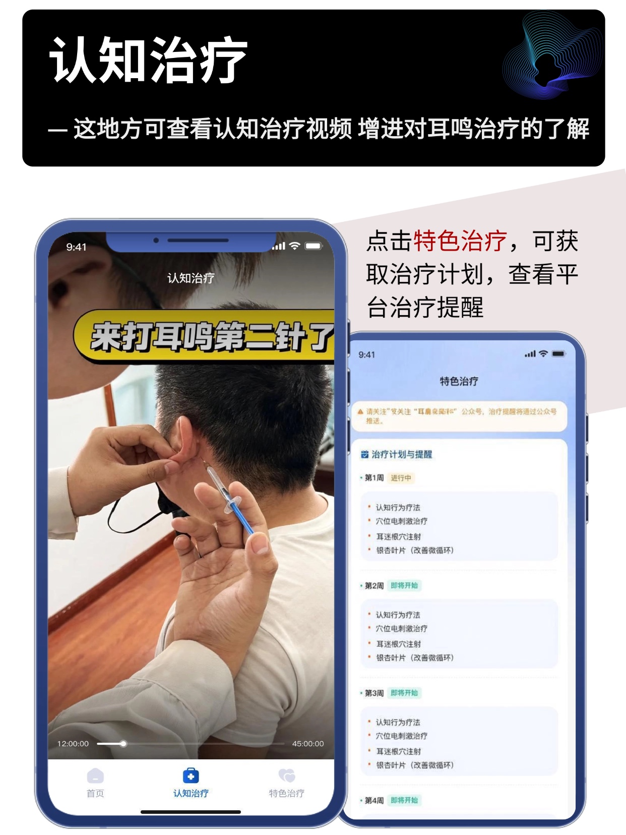 认知治疗